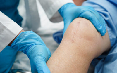 Does Medicare Cover Knee Replacement Surgery?